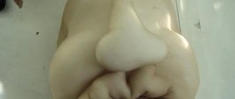 Garden dolls from Zapolaria